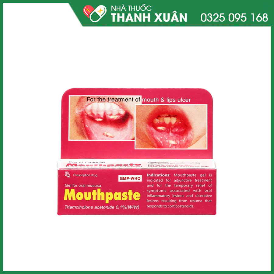Mouthpaste 0.1% gel bôi điều trị viêm ở niêm mạc miệng, lợi và môi