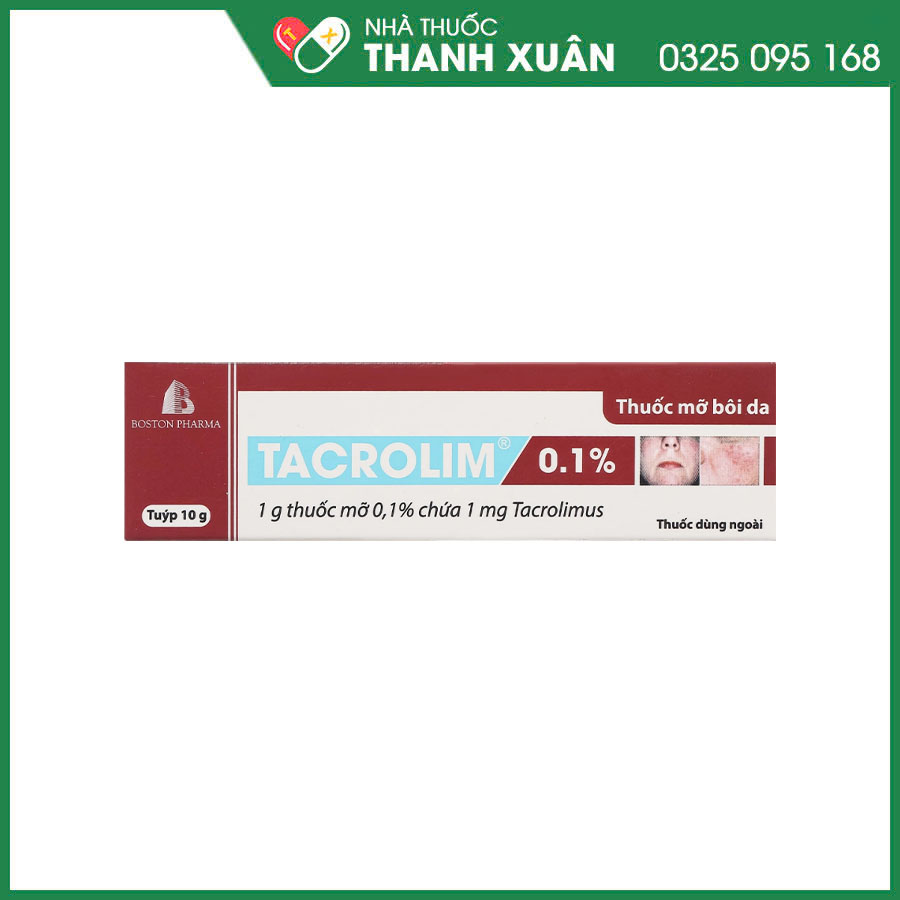 TACROLIM 0.1% thuốc mỡ bôi da điều trị viêm da cơ địa